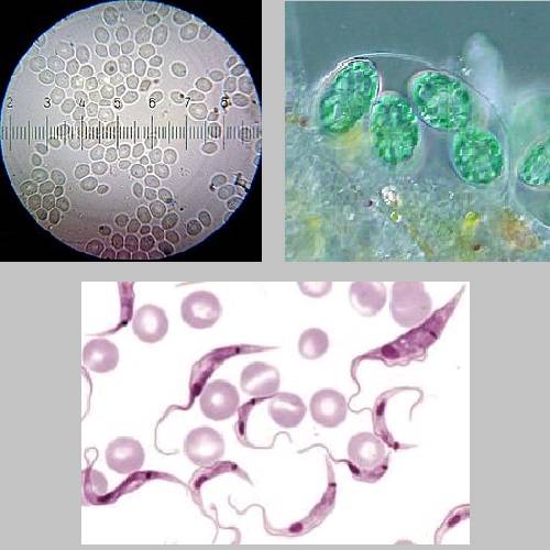 Exemplos de Microrganismos Eucariontes